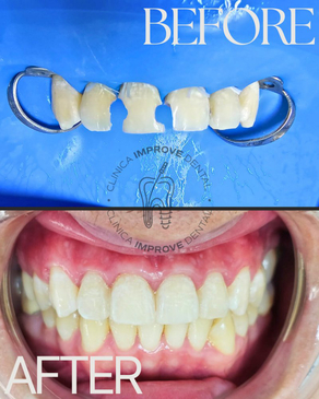 Slider image (4) Improve Dental